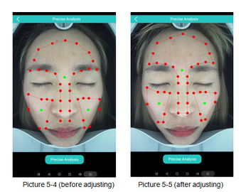 CE facial del sistema de análisis de Digitaces del analizador médico de la piel 3D certificado