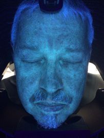 Analizador profesional de la hidración de la piel de la arruga 3D con el pixel del megapíxel 18