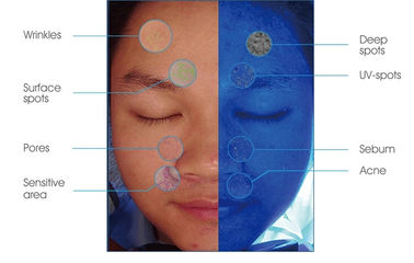 Humedad facial 9kg nanovatio del analizador ultravioleta casero con la configuración de la tableta