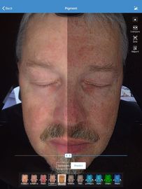 El analizador de la piel de la cara para la cara de la clínica hace un care-test, analizador facial de la piel