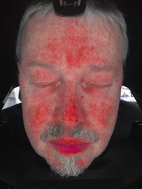 Análisis facial del escáner de la piel, máquina del analizador de la piel con el certificado del Ce
