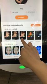 Almacenamiento facial de Digitaces 64gb del sistema de análisis de Corea para el doctor Clinic