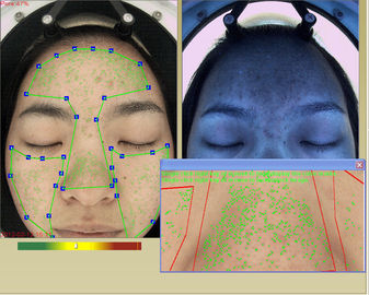 Máquina facial profesional del analizador de la hidración de la piel 3d con la pantalla táctil