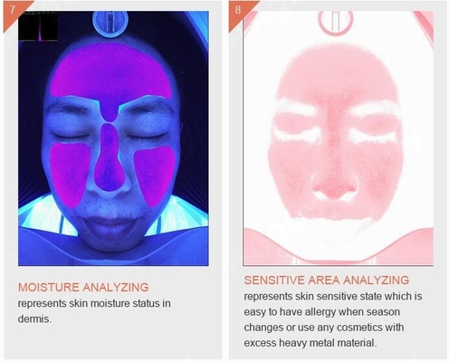 Concursos elegantes de la máquina 3D del analizador de la piel del acné de la pigmentación de la arruga de Skincare