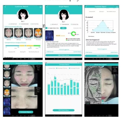 Cámara facial de la piel del analizador profesional de la hidración pantalla 20MP de 10,4 pulgadas