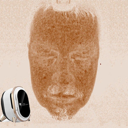 Analizador portátil profesional de la piel, voltaje facial del análisis 110-220V de la piel